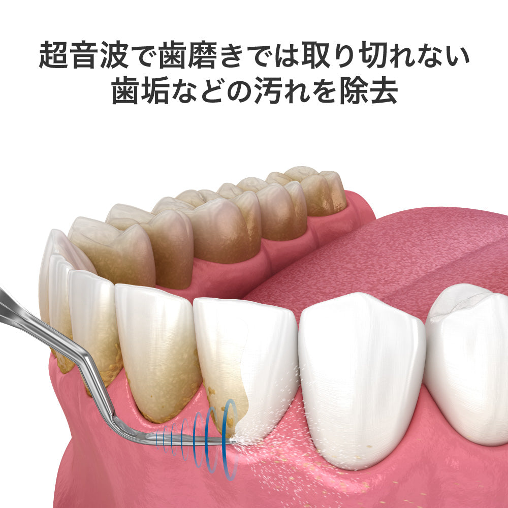 ecleaner 超音波の力で歯垢・汚れを除去!毎日の口腔ケアに新提案「超音波デンタルクリーナー」