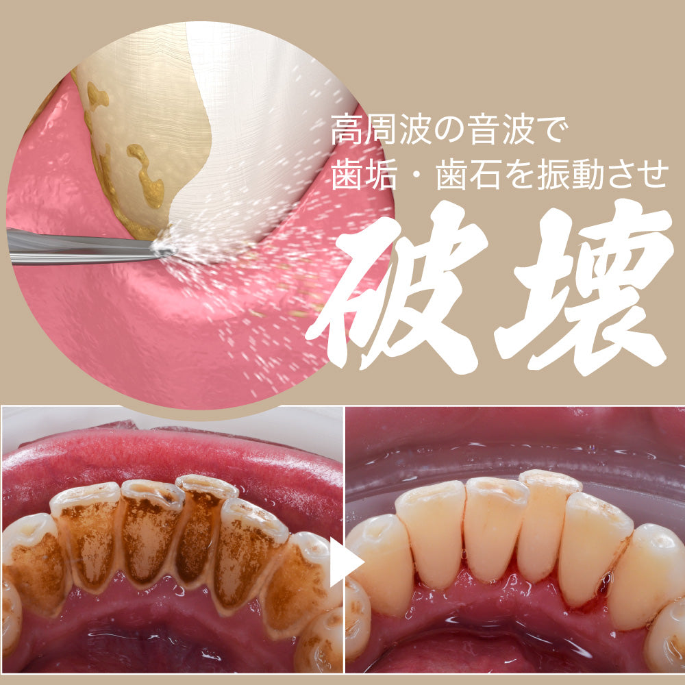ecleaner 超音波の力で歯垢・汚れを除去!毎日の口腔ケアに新提案「超音波デンタルクリーナー」