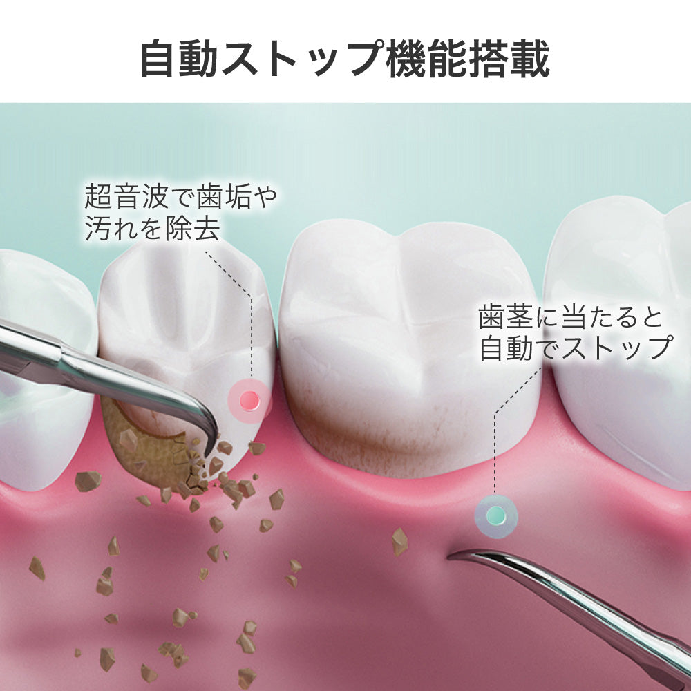 ecleaner 超音波の力で歯垢・汚れを除去!毎日の口腔ケアに新提案「超音波デンタルクリーナー」