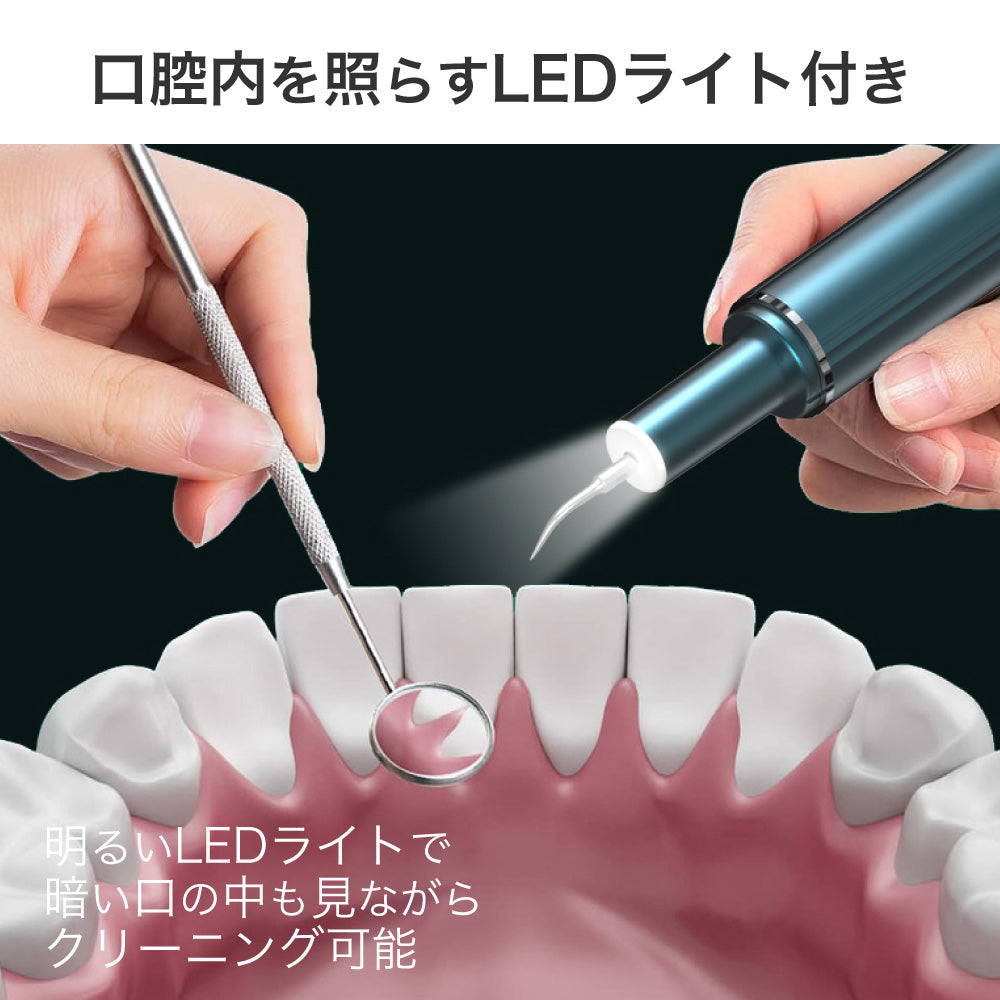 ecleaner 超音波の力で歯垢・汚れを除去!毎日の口腔ケアに新提案「超音波デンタルクリーナー」